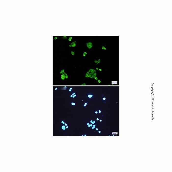 Recombinant PGD Antibody -    by Aladdin Scientific
