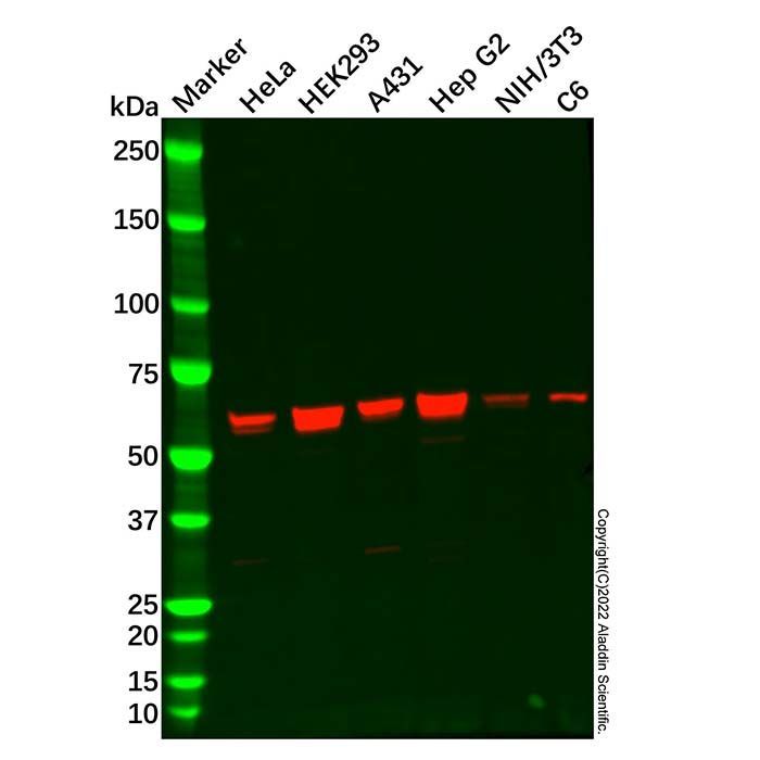 PGM1 Antibody -    by Aladdin Scientific