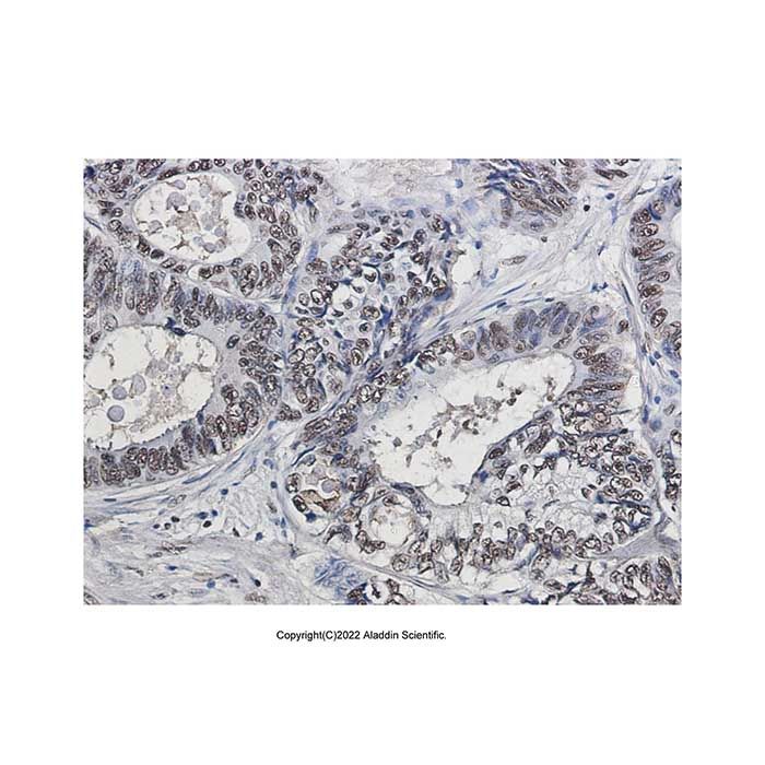 Recombinant PHAPI2/APRIL Antibody -    by Aladdin Scientific
