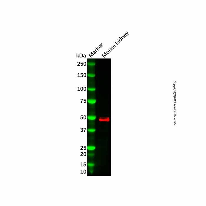 Recombinant PHD2/prolyl hydroxylase Antibody -    by Aladdin Scientific