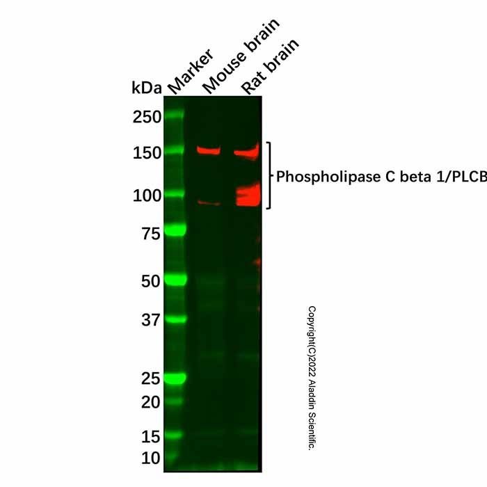 Phospholipase C beta 1/PLCB1 Mouse mAb -    by Aladdin Scientific