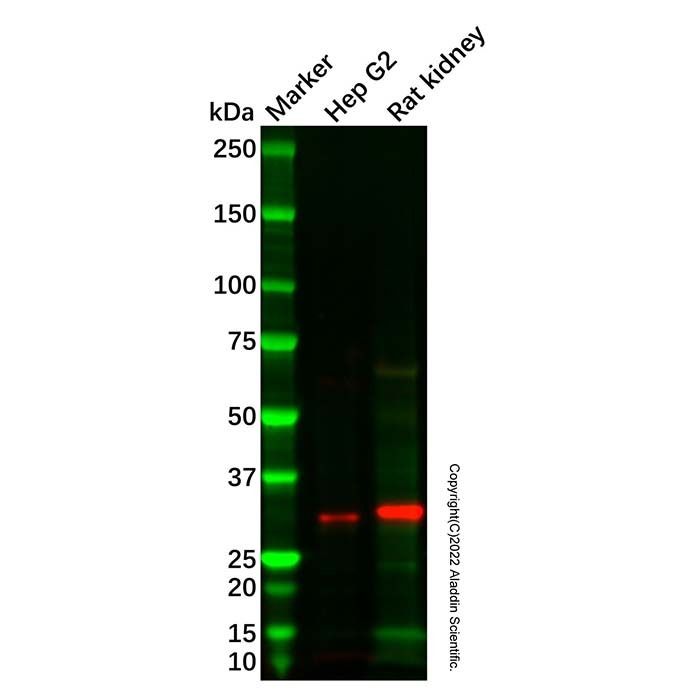 PHYHD1 Mouse mAb -    by Aladdin Scientific