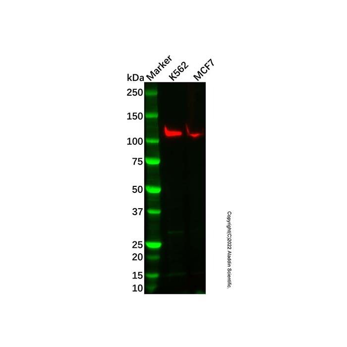Recombinant PI3 Kinase p110 beta Antibody -    by Aladdin Scientific