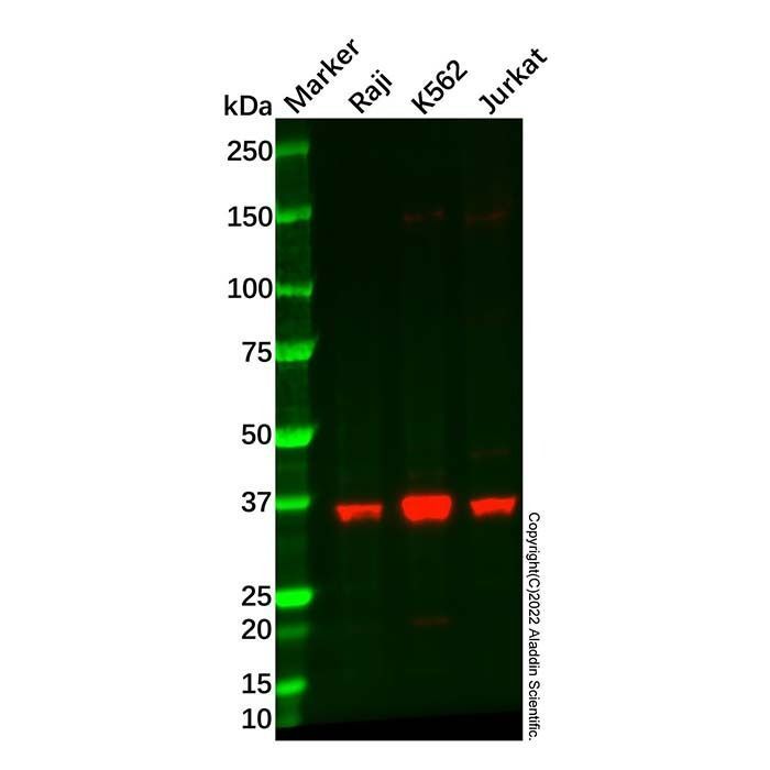 Recombinant PIM2 Antibody -    by Aladdin Scientific
