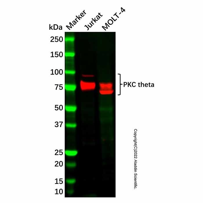 Recombinant PKC theta Antibody -    by Aladdin Scientific