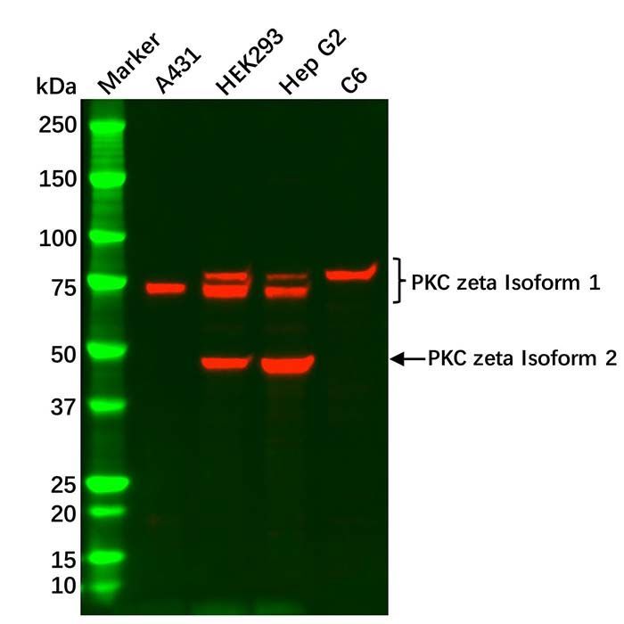PKC zeta Antibody -    by Aladdin Scientific