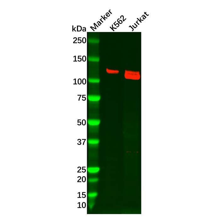 Recombinant PKN2 Antibody -    by Aladdin Scientific