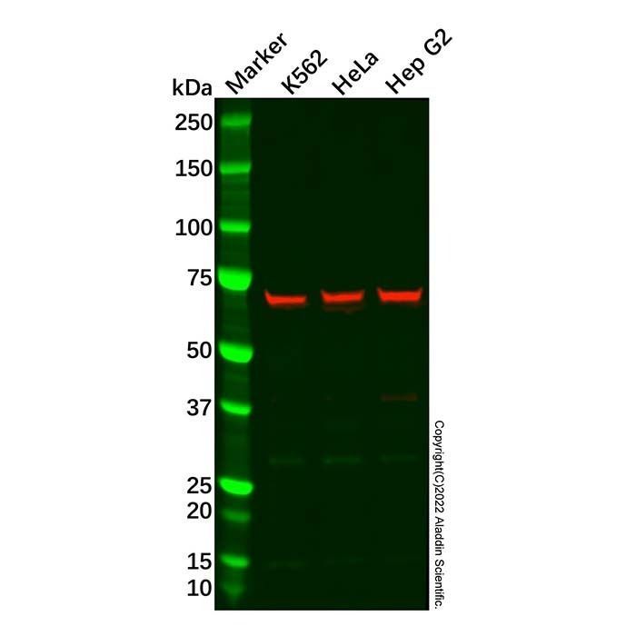 Recombinant PKR Antibody -    by Aladdin Scientific