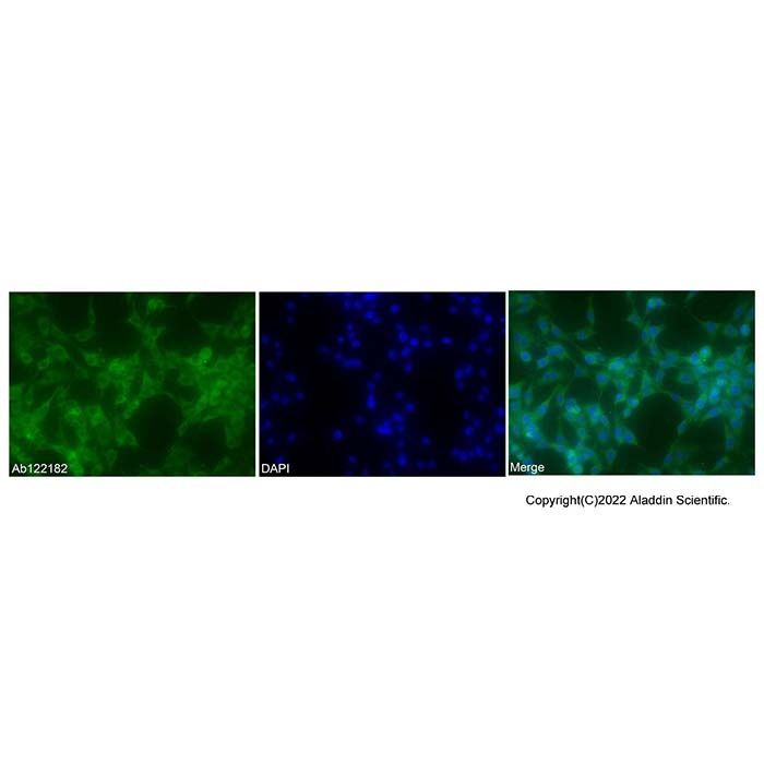 PLA1A/NMD Antibody -    by Aladdin Scientific