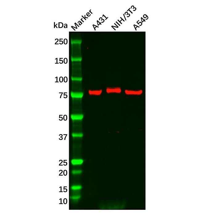 PLA2G4D Antibody -    by Aladdin Scientific