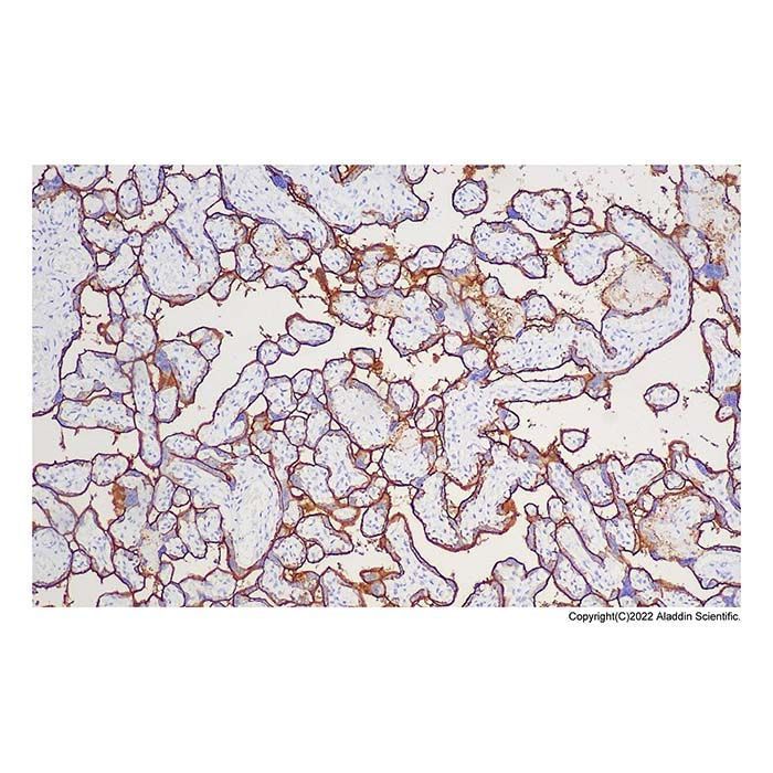 Recombinant Placental alkaline phosphatase (PLAP) Antibody -    by Aladdin Scientific