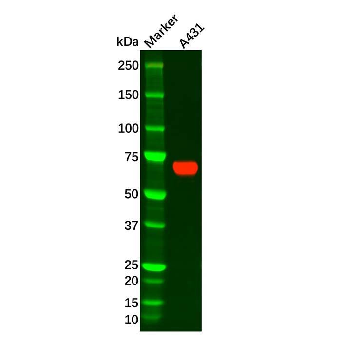 Placental alkaline phosphatase (PLAP) Antibody -    by Aladdin Scientific