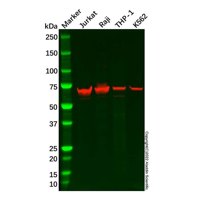 Plastin L Antibody -    by Aladdin Scientific
