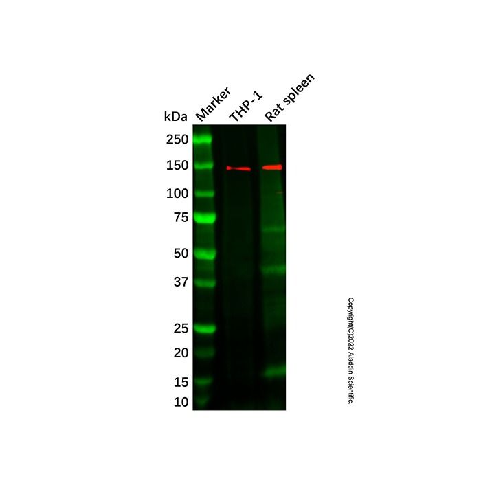Recombinant PLCG 2 Antibody -    by Aladdin Scientific