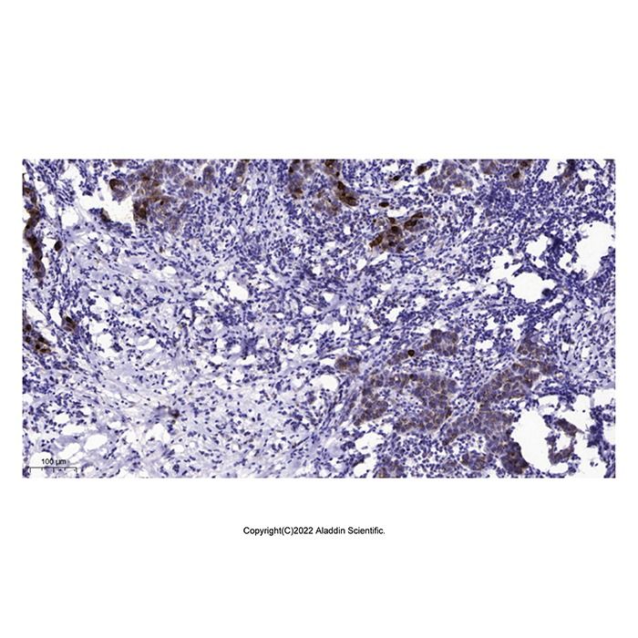 PLP2 Antibody -    by Aladdin Scientific