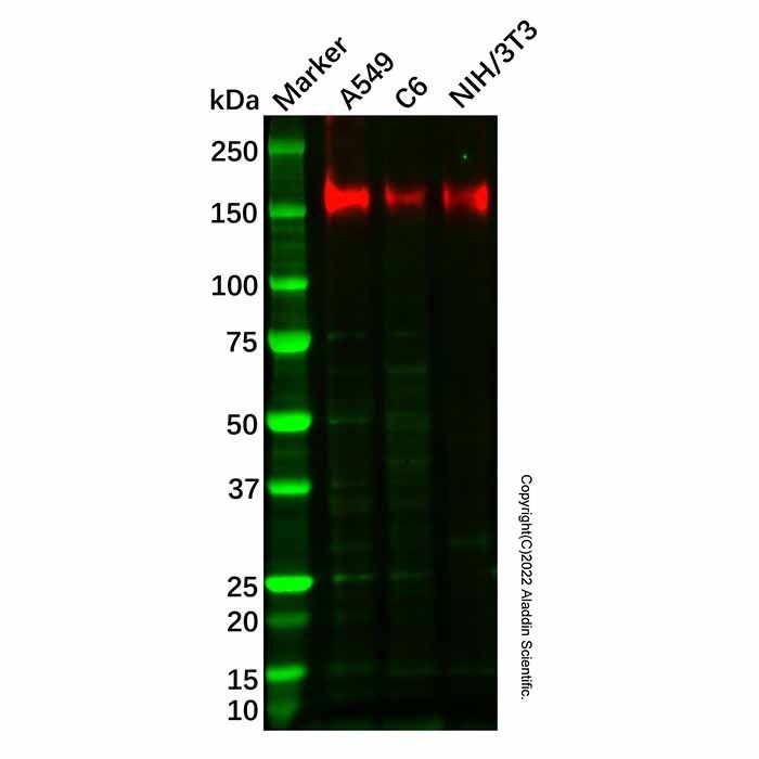 Recombinant PMCA1 Antibody -    by Aladdin Scientific