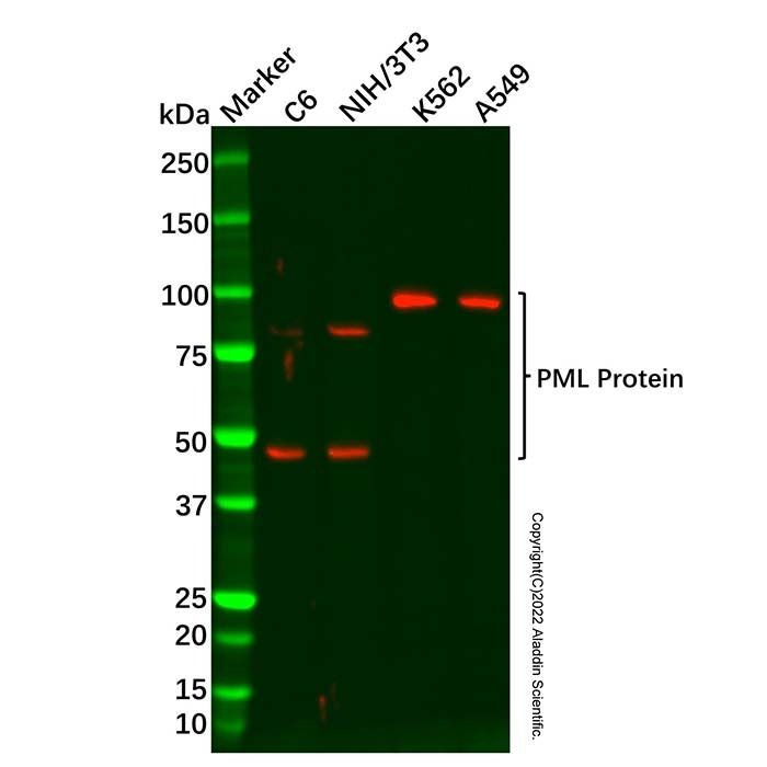 PML Protein Antibody -    by Aladdin Scientific