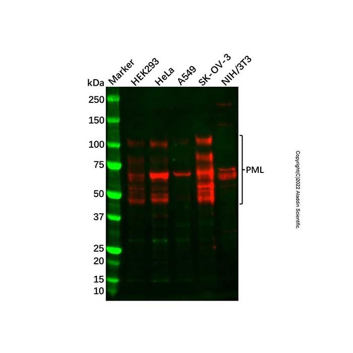 Recombinant PML Antibody -    by Aladdin Scientific