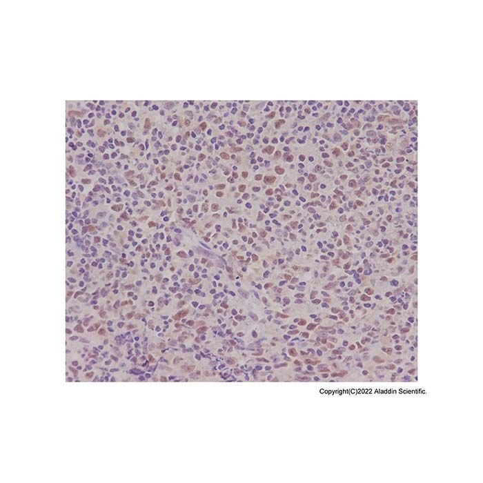 PMS2 Antibody -    by Aladdin Scientific
