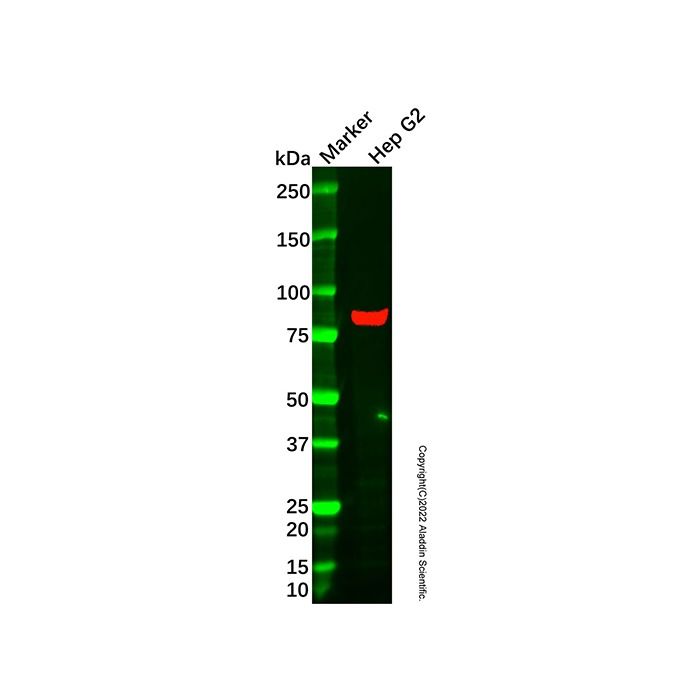 PNPLA8 Antibody -    by Aladdin Scientific