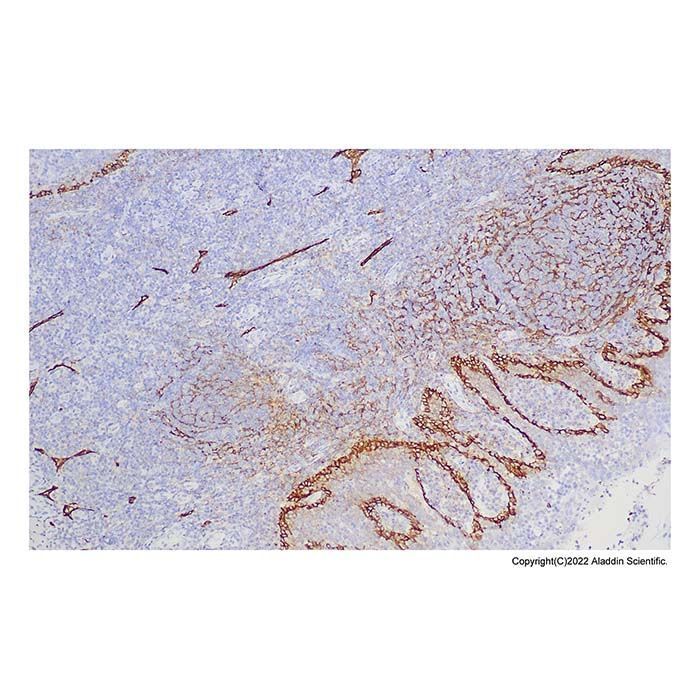 Recombinant Podoplanin Antibody -    by Aladdin Scientific