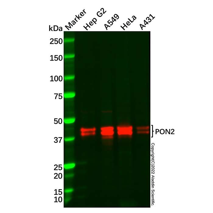 Recombinant PON2 Antibody -    by Aladdin Scientific
