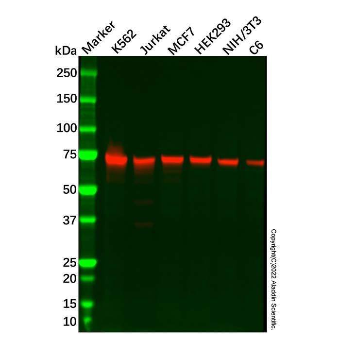 Recombinant PPM1G Antibody -    by Aladdin Scientific