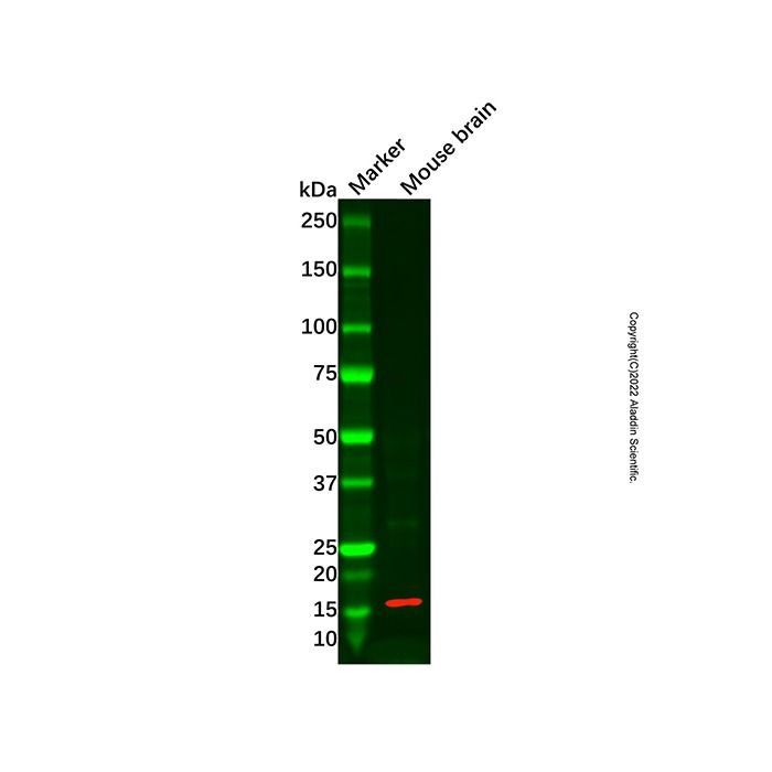 PPP3R2 Antibody -    by Aladdin Scientific