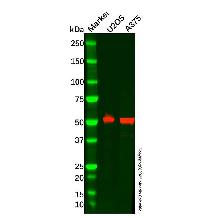 Recombinant PRAME Antibody -    by Aladdin Scientific