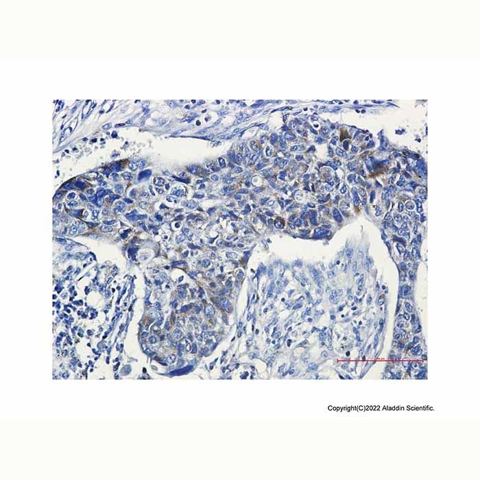 Recombinant PRC1 Antibody -    by Aladdin Scientific