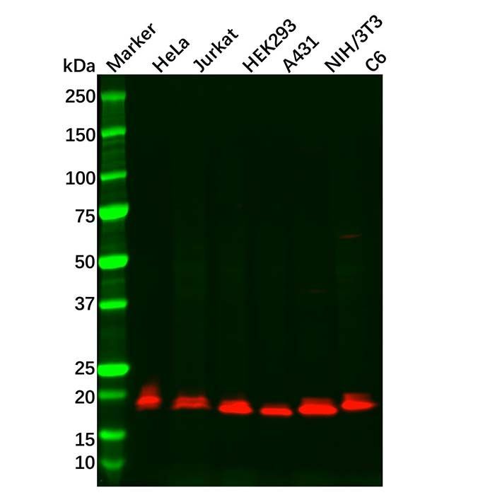 Recombinant Presenilin 1/PS-1 Antibody -    by Aladdin Scientific