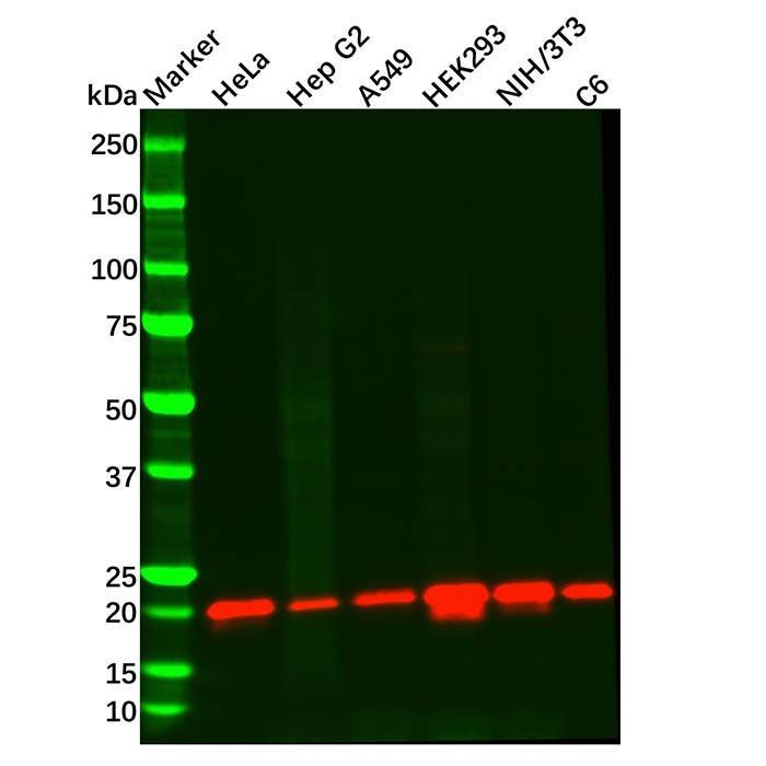 Recombinant Presenilin 2/AD5 Antibody -    by Aladdin Scientific