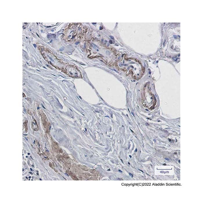 Recombinant Prion protein PrP Antibody -    by Aladdin Scientific