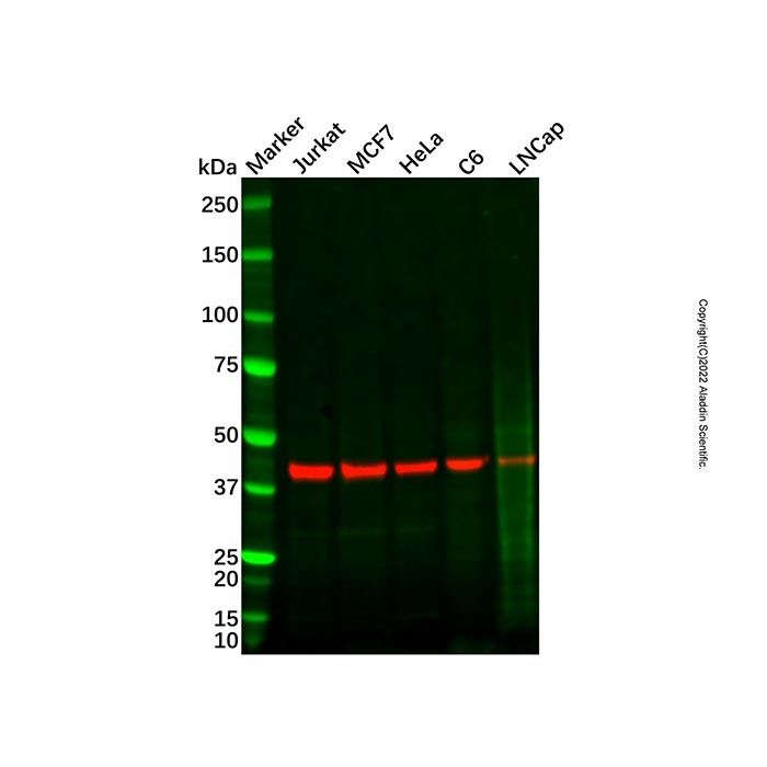 Recombinant PRMT6 Antibody -    by Aladdin Scientific