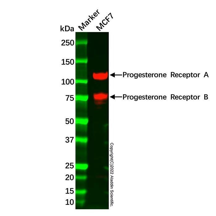 Recombinant Progesterone Receptor Antibody -    by Aladdin Scientific