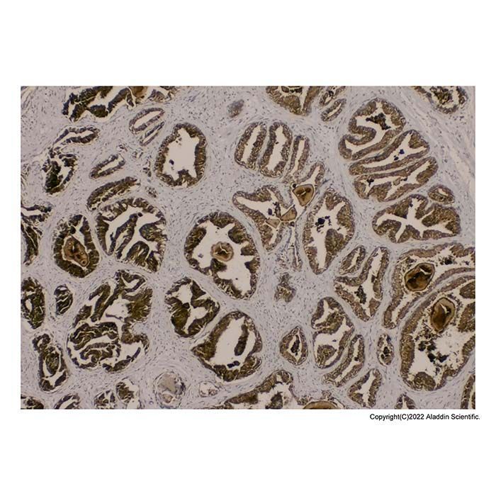 Recombinant Prostate Specific Antigen Antibody -    by Aladdin Scientific