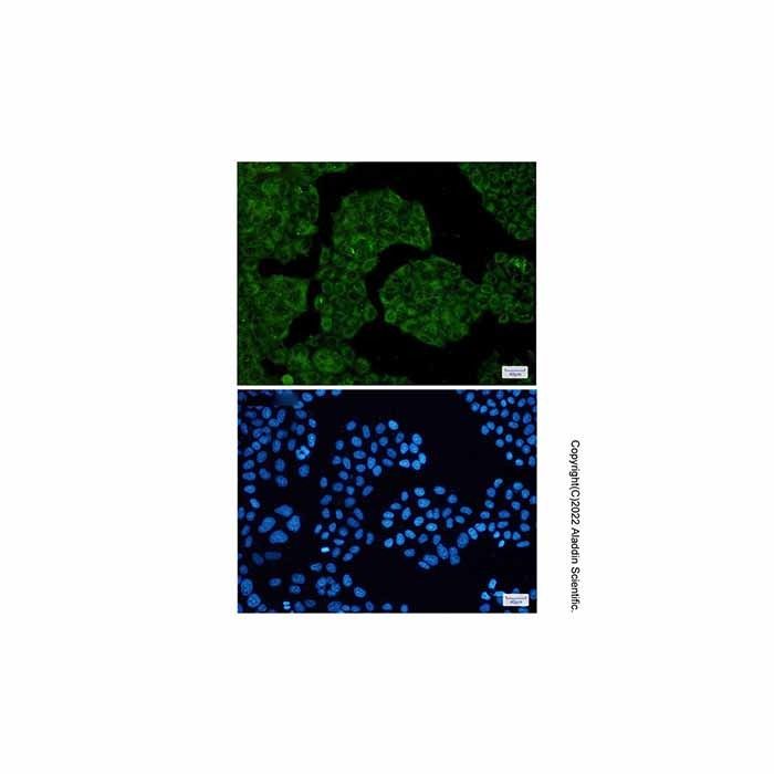 Recombinant PRPF31 Antibody -    by Aladdin Scientific