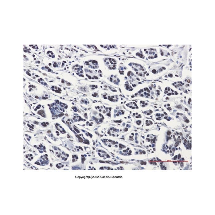Recombinant PRPF4 Antibody -    by Aladdin Scientific