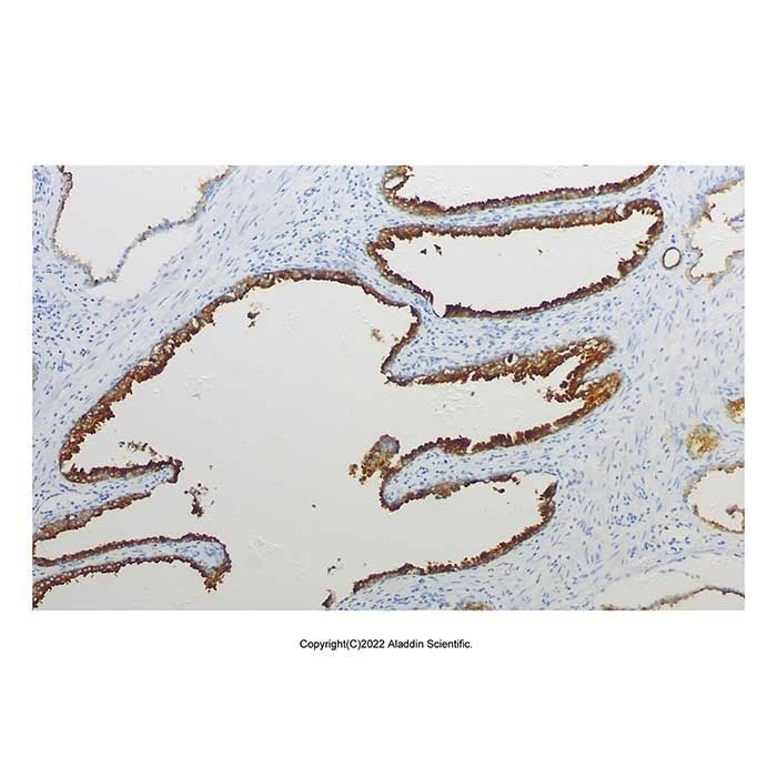Recombinant PSMA Antibody -    by Aladdin Scientific