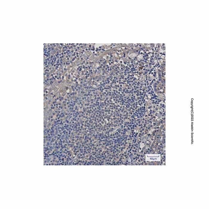 Recombinant PSMA4 Antibody - by Aladdin Scientific