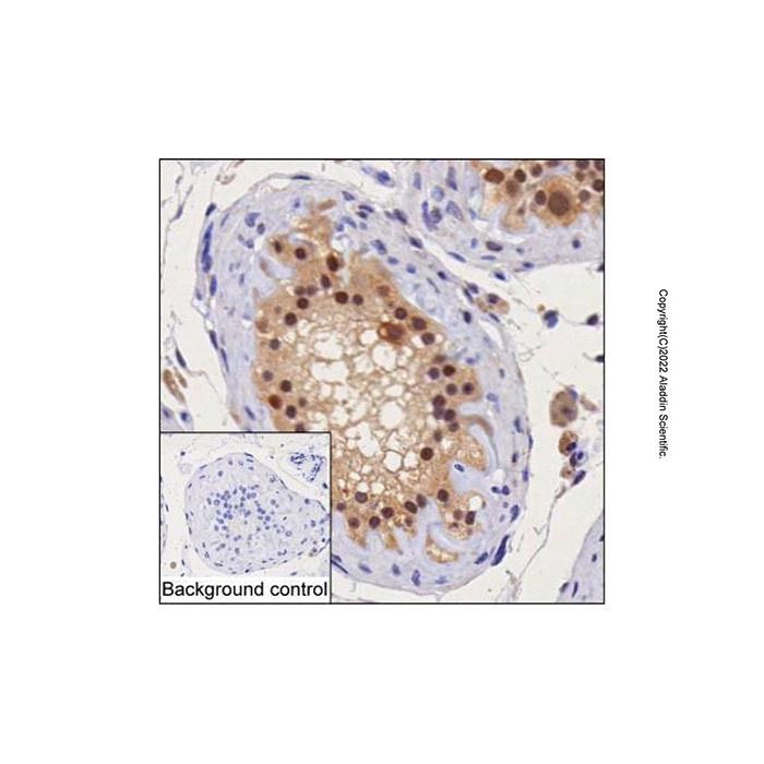 PSMD1 Mouse mAb -    by Aladdin Scientific