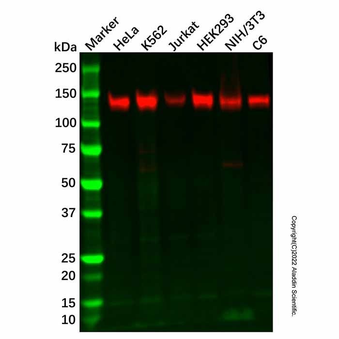 Recombinant Pumilio 1 Antibody -    by Aladdin Scientific