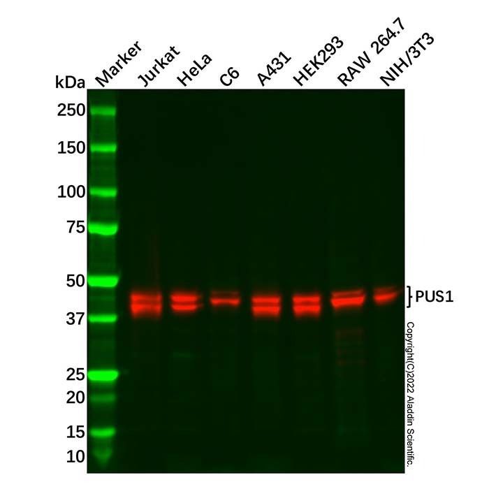 Recombinant PUS1 Antibody -    by Aladdin Scientific