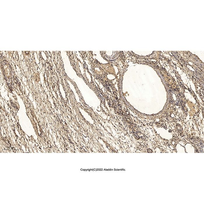 PVRIG/CD112R Antibody -    by Aladdin Scientific