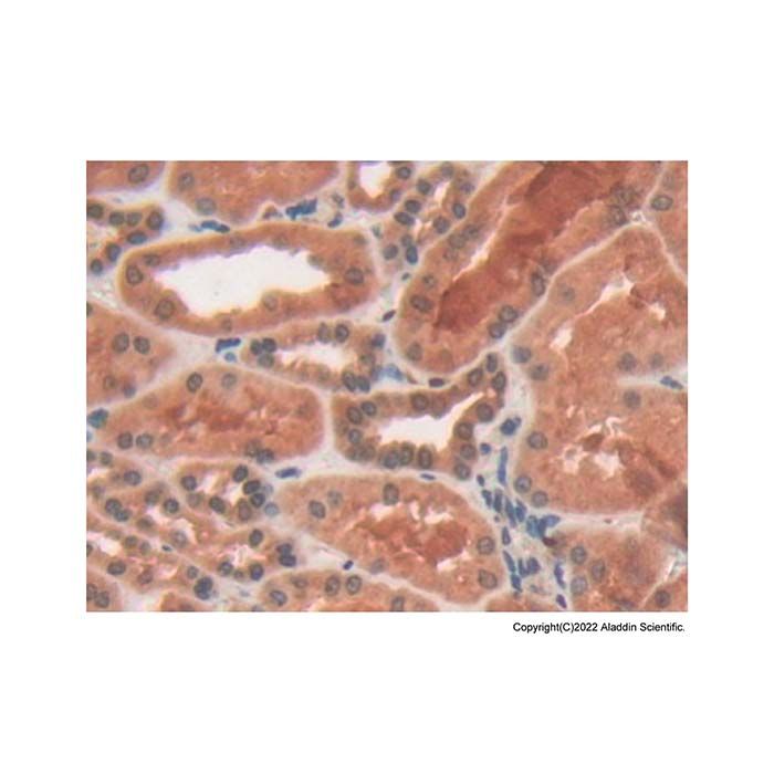 PYGL Antibody -    by Aladdin Scientific