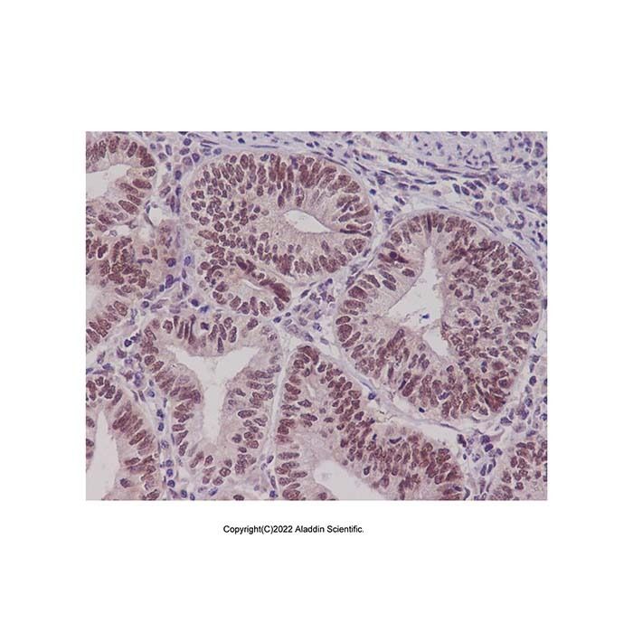 Recombinant PYGO2 Antibody -    by Aladdin Scientific