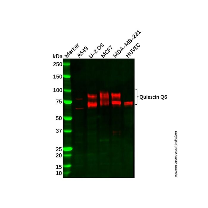 Recombinant Quiescin Q6 Antibody -    by Aladdin Scientific