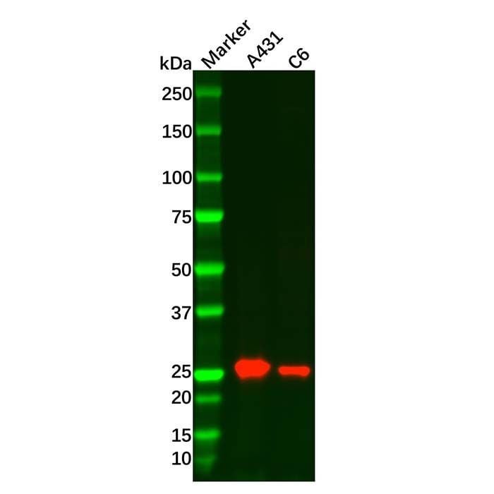 RAB27B Mouse mAb - by Aladdin Scientific