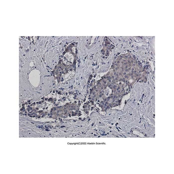 Recombinant RACK1 Antibody -    by Aladdin Scientific