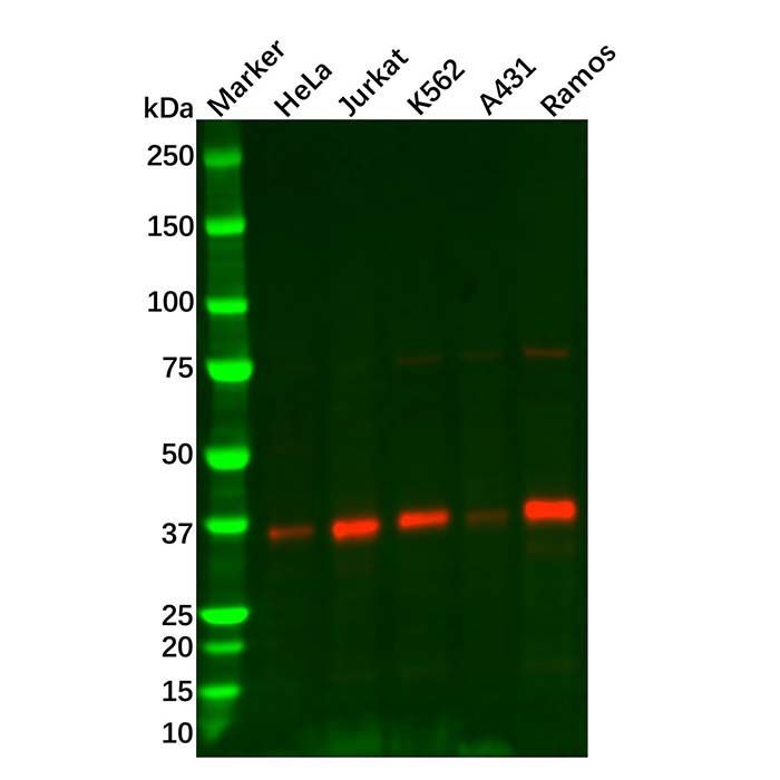 Rad51 Mouse mAb -    by Aladdin Scientific